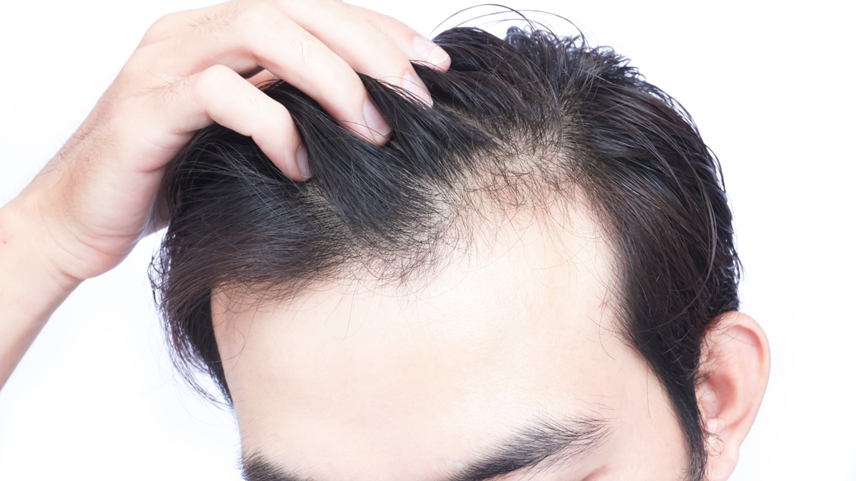 Is it true that stress can cause hair loss?