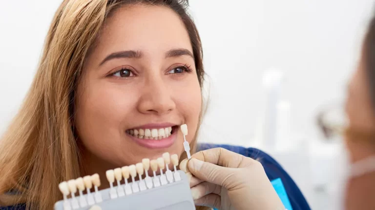 Transforming Smiles Through the Magic of Porcelain Veneers