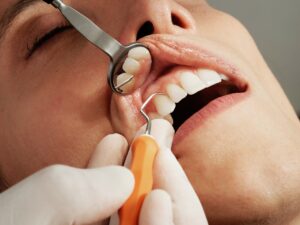 Why Regular Visits to a Dentist are A Must For Everyone?