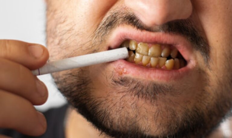 Effects of Vaping On Your Dental Health