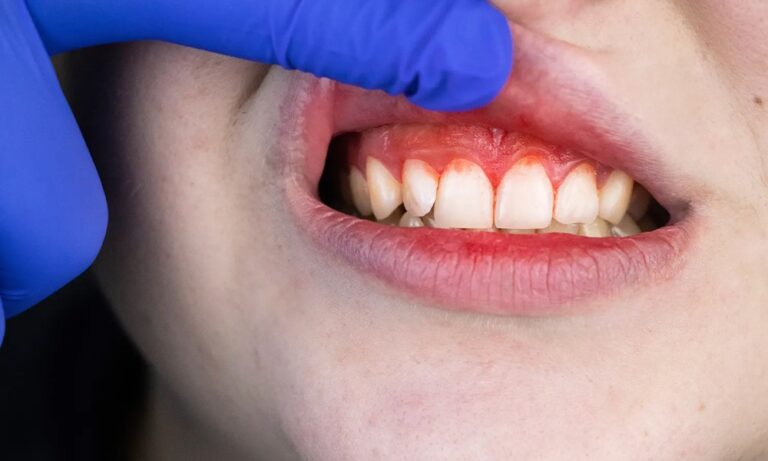 Protect Your Oral Health: Essential Guide to Preventing Dental Problems